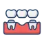 dental bridge