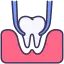 tooth extraction